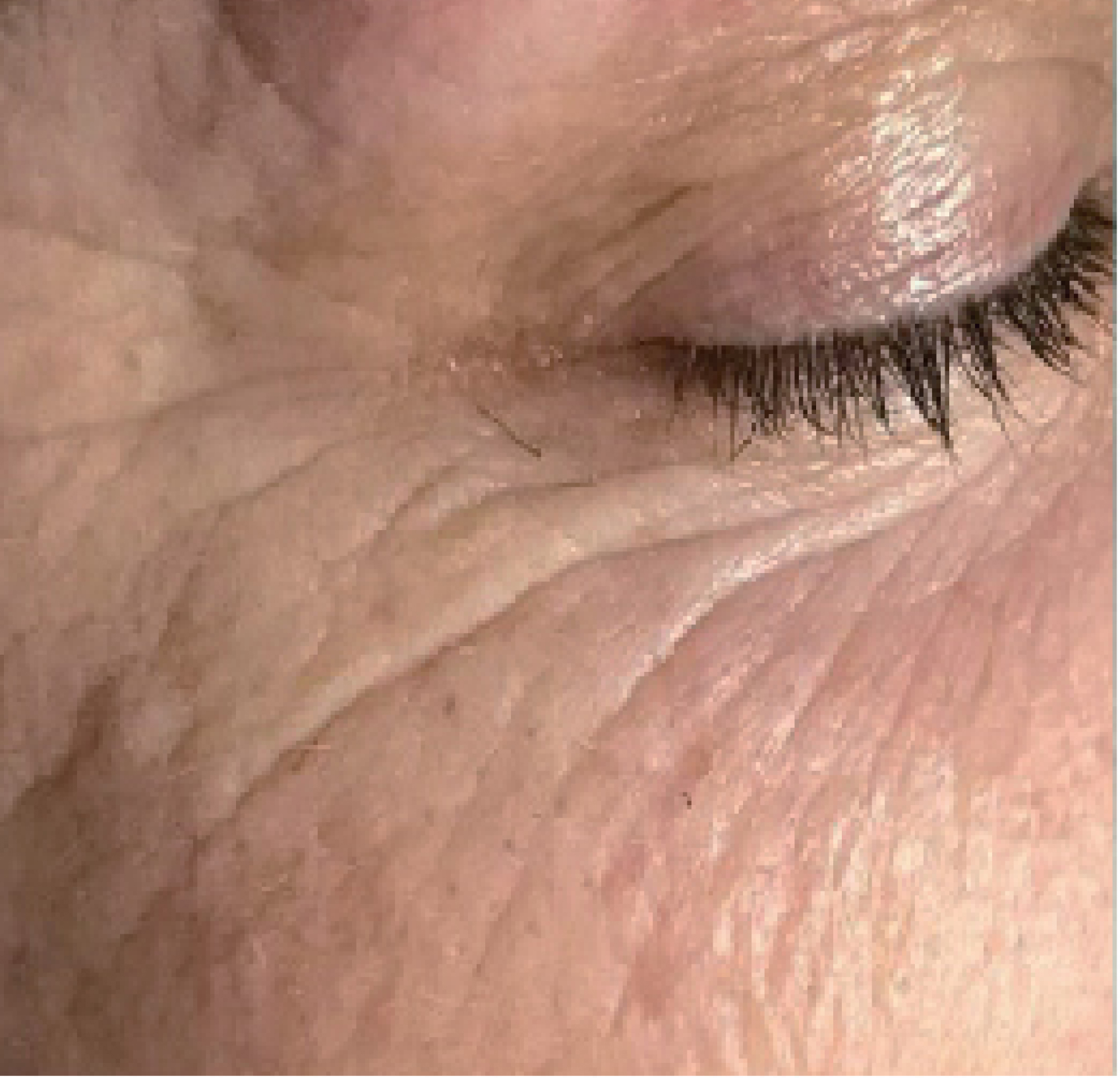 Inpure Multi-Active Therapy — Przed