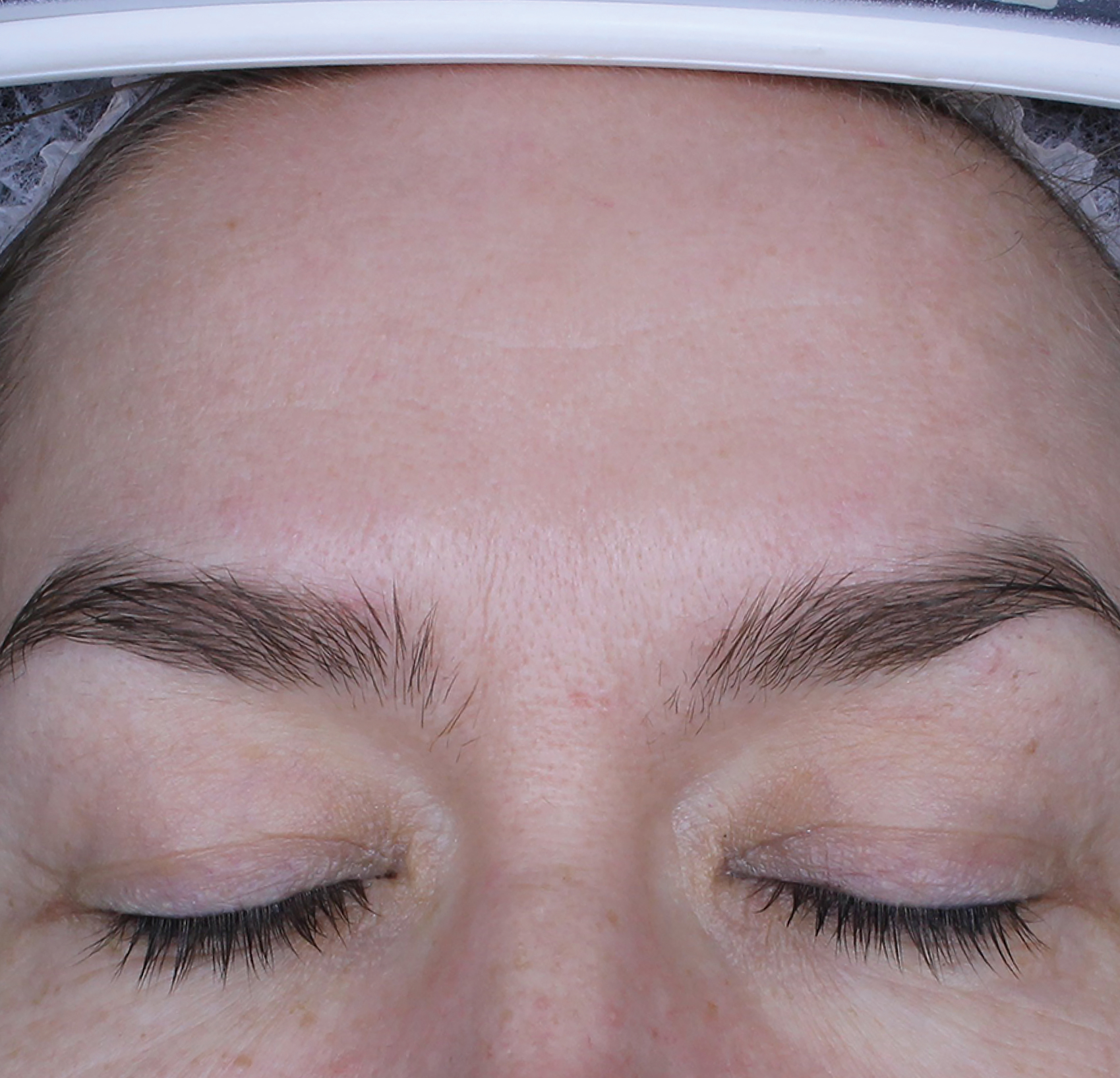 Cosmo S-Peel™ Nano Boost — Po